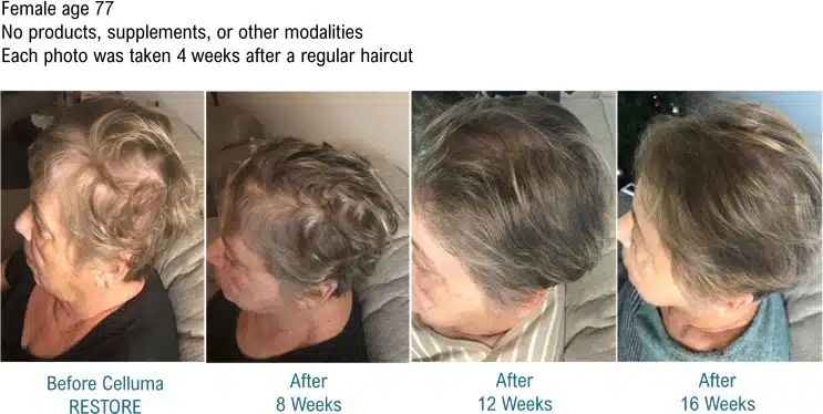 Celluma RESTORE resultat